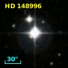 HD 148996