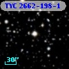 TYC 2662-198-1