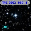 TYC 2662-992-1