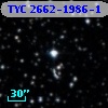 TYC 2662-1986-1
