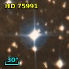 HD  75991