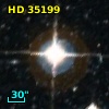 HD  35199