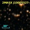 2MASX J10005527-4912534
