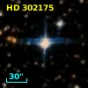 HD 302175
