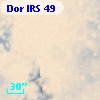 Dor IRS  49