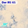 Dor IRS  65