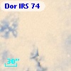 Dor IRS  74