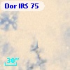 Dor IRS  75