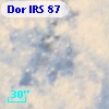 Dor IRS  87