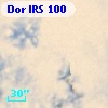 Dor IRS 100
