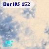 Dor IRS 152