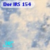 Dor IRS 154