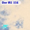 Dor IRS 156