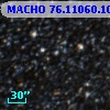 MACHO  76.11060.10