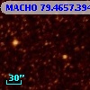 MACHO  79.4657.3945