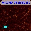MACHO  79.5382.51