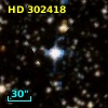 HD 302418