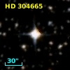 HD 304665
