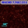 MACHO   7.7662.551