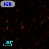 IGR J05009-7044
