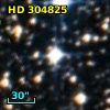 HD 304825