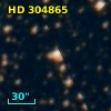 HD 304865