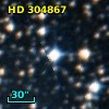HD 304867