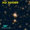 HD 304989