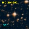 HD 304991