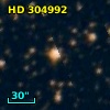 HD 304992