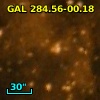 GAL 284.56-00.18