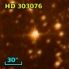 HD 303076