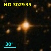 HD 302935