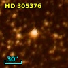 HD 305376