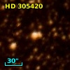 HD 305420