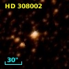 HD 308002