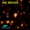 HD 301435