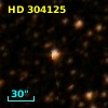 HD 304125