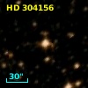HD 304156