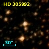 HD 305992