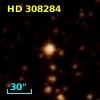 HD 308284