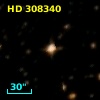 HD 308340