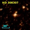 HD 308307