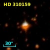 HD 310159