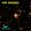 HD 301662