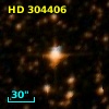 HD 304406