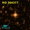 HD 304377