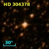 HD 304378