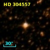 HD 304557