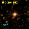 HD 304562
